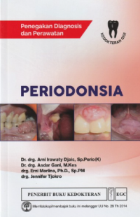 Penegakan Diagnosis Dan Perawatan Periodonsia