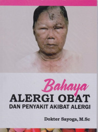 Bahaya alergi obat dan penyakit alergi