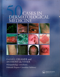 50 (Fifty)  ceses in dermatological medicine